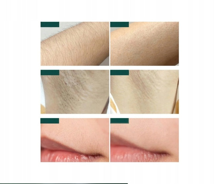 Depiless - Depilator IPL