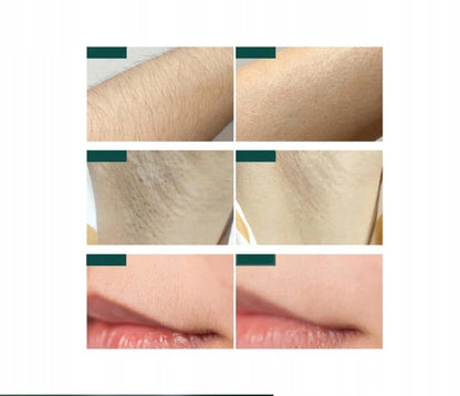 Depiless - Depilator IPL